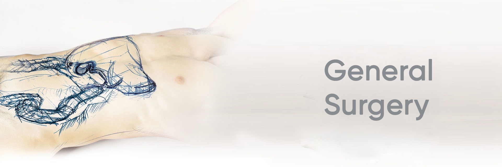 General Surgery